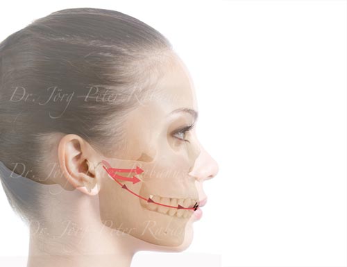 Comprehensive Smile Makeover comprehensive smile makeover