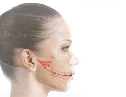 Comprehensive Smile Makeover comprehensive smile makeover