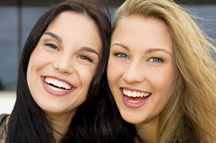 porcelain veneers san francisco faq