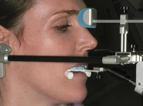 Smile Makeover Facebow smile makeover facebow