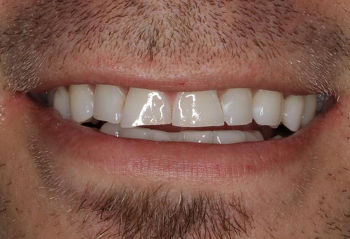 San Francisco Best Cosmetic Dentist best cosmetic dentist san francisco