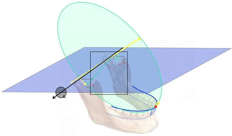 Centric Relation Mandible centric relation mandible