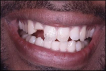 before cosmetic dentistry