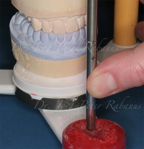 dental articulator function