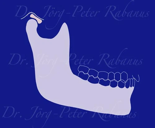 healthy teeth jaw position