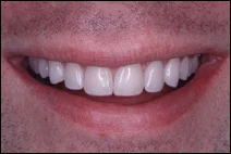 after treatment by cosmetic dentist