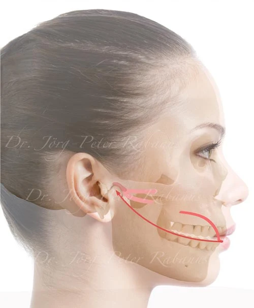 relaxed lateral pterygoid muscle