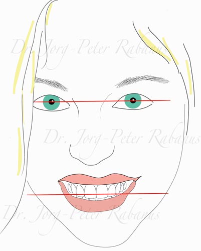 Interpupillary Line smile design reference 1
