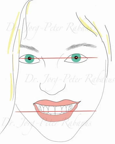 Interpupillary Line smile design reference 1
