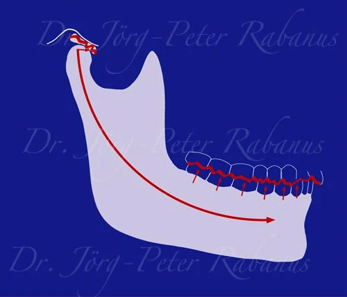 worn teeth jaw position