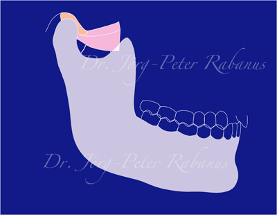 Relationship between teeth, joints, and muscles - centric relation