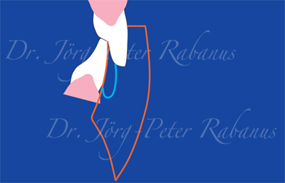 The Envelope of finction is an important aspect of cosmetic dentistry smile design key element