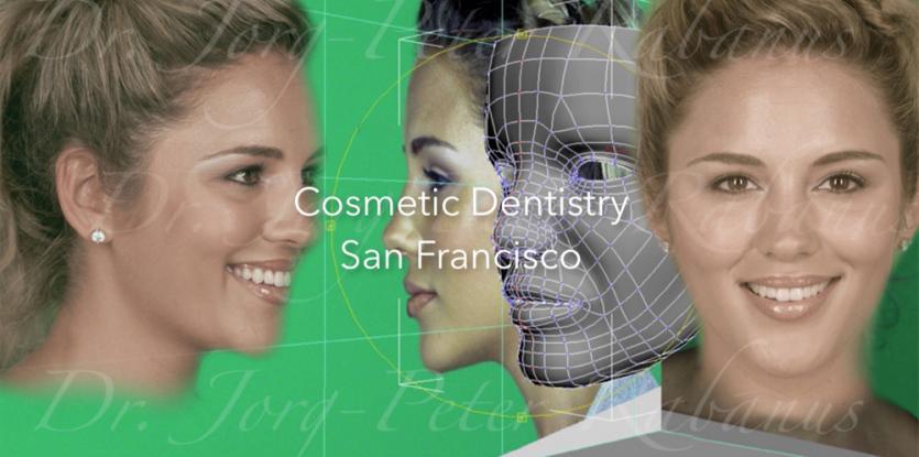 Tooth Design for Porcelain Veneers